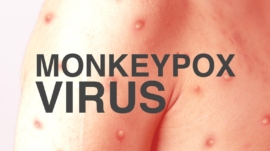 Monkey Pox Virus