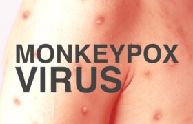 Monkey Pox Virus