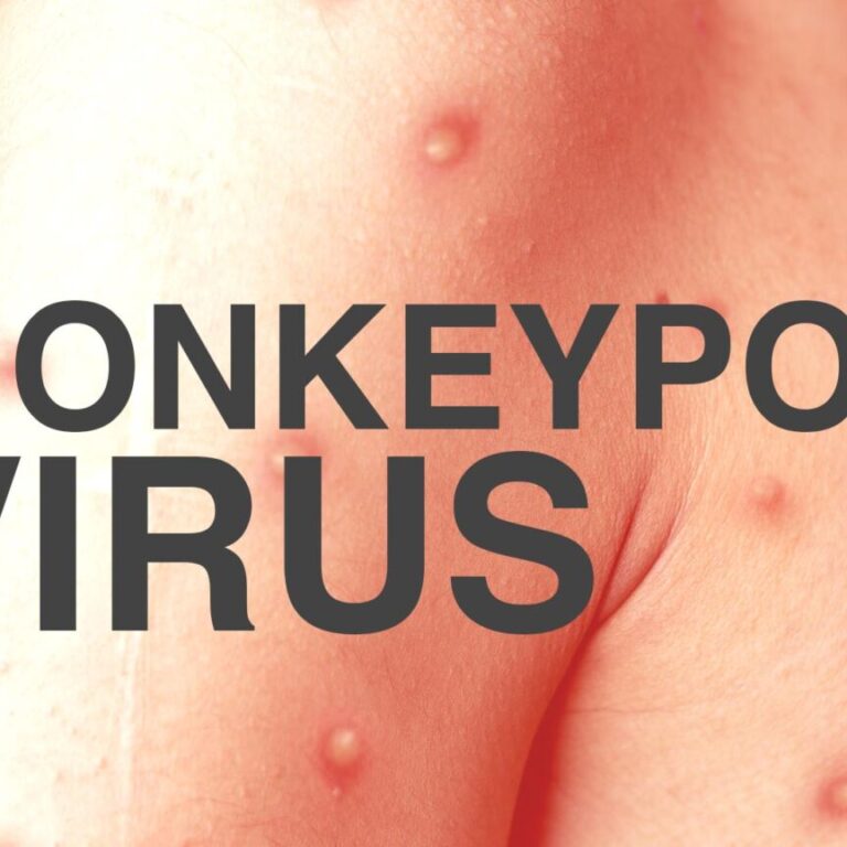 Monkey Pox Virus