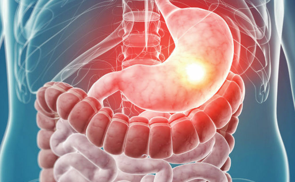 Due to extreme heat in Khyber Pakhtunkhwa, cases of gastro and diarrhea have increased