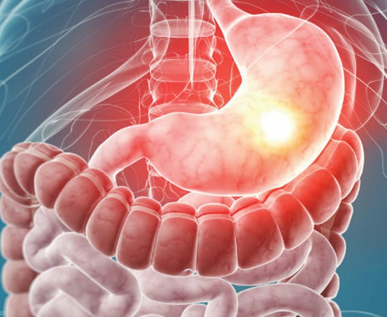 Due to extreme heat in Khyber Pakhtunkhwa, cases of gastro and diarrhea have increased