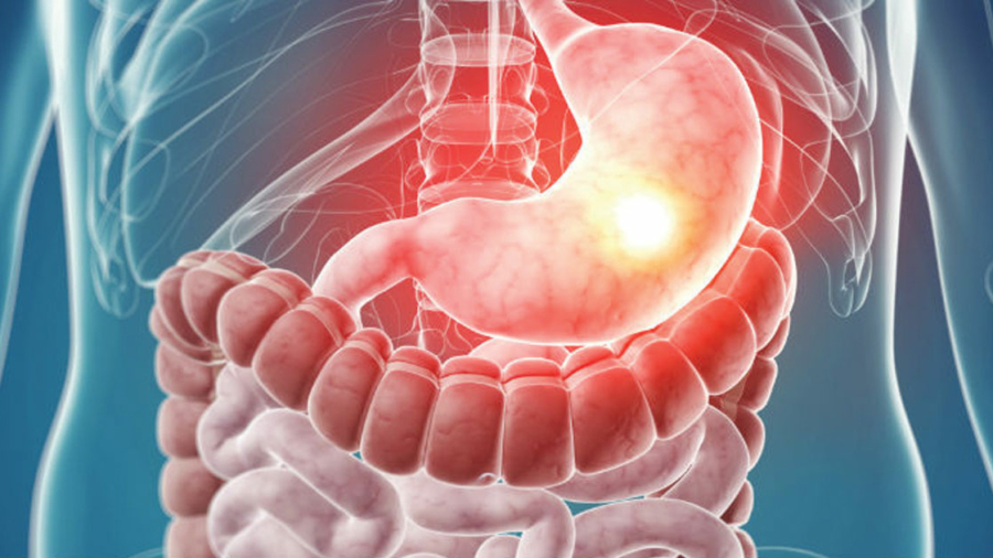 Due to extreme heat in Khyber Pakhtunkhwa, cases of gastro and diarrhea have increased