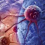 Peshawar: "CancerCon 18" conference held.