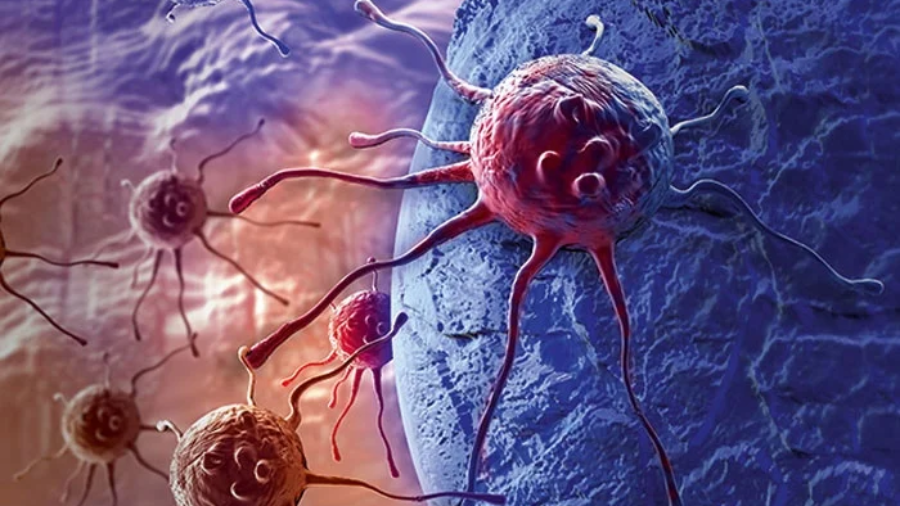 Peshawar: "CancerCon 18" conference held.