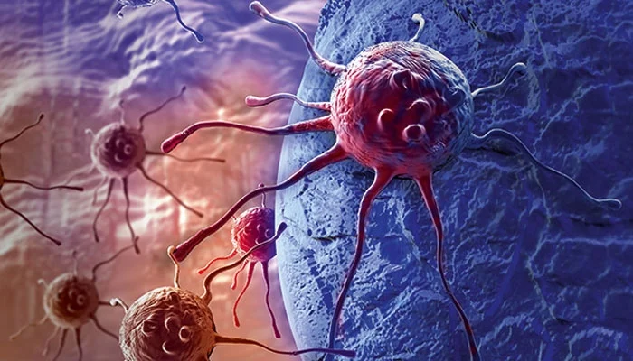 Peshawar: "CancerCon 18" conference held.